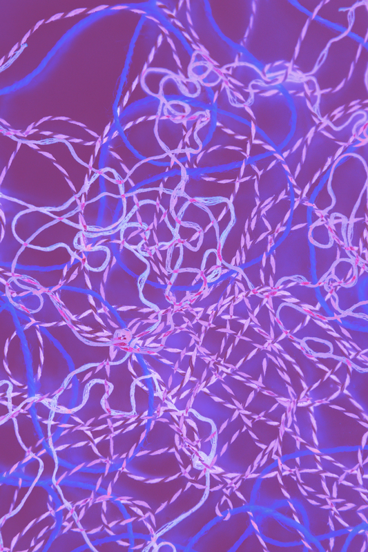 Connection